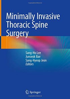 Minimally Invasive Thoracic Spine Surgery (Original PDF from Publisher)