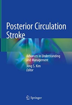 Posterior Circulation Stroke: Advances in Understanding and Management (Original PDF from Publisher)