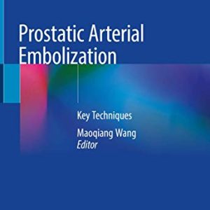 Prostatic Arterial Embolization: Key Techniques (Original PDF from Publisher)