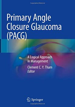 Primary Angle Closure Glaucoma (PACG): A Logical Approach in Management (Original PDF from Publisher)