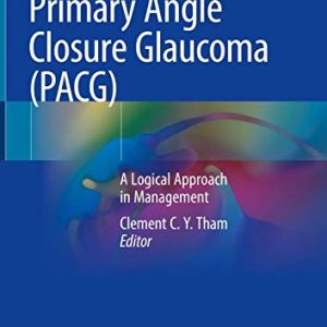 Primary Angle Closure Glaucoma (PACG): A Logical Approach in Management (Original PDF from Publisher)