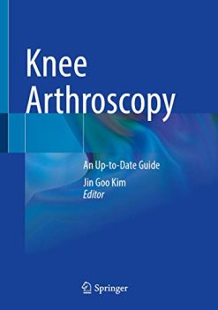 Knee Arthroscopy: An Up-to-Date Guide (Original PDF from Publisher)