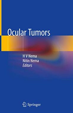 Ocular Tumors (Original PDF from Publisher)