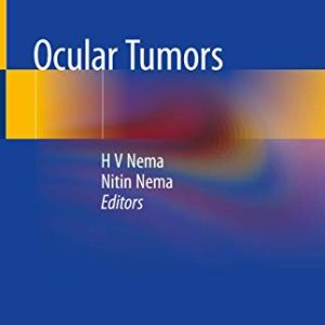 Ocular Tumors (Original PDF from Publisher)
