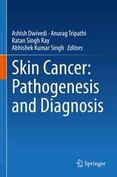 Skin Cancer: Pathogenesis and Diagnosis (Original PDF from Publisher)