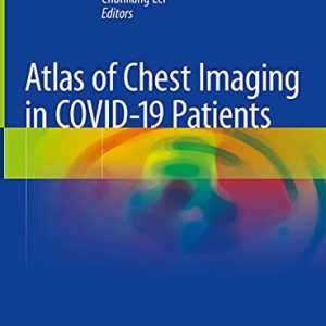 Atlas of Chest Imaging in COVID-19 Patients (Original PDF from Publisher)