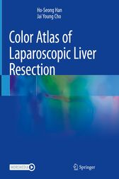 Color Atlas of Laparoscopic Liver Resection (Original PDF from Publisher)