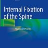 Internal Fixation of the Spine: Principles and Practice (Original PDF from Publisher)