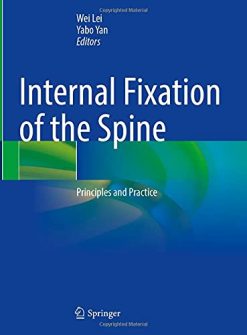Internal Fixation of the Spine: Principles and Practice (Original PDF from Publisher)
