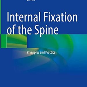 Internal Fixation of the Spine: Principles and Practice (Original PDF from Publisher)