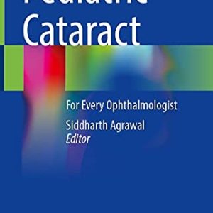 Pediatric Cataract: For Every Ophthalmologist (Original PDF from Publisher)