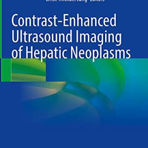 Contrast-Enhanced Ultrasound Imaging of Hepatic Neoplasms (Original PDF from Publisher)