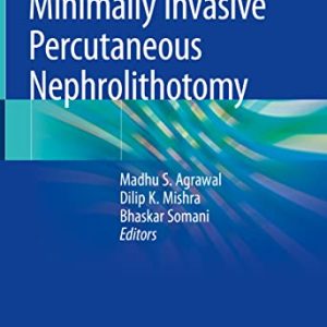 Minimally Invasive Percutaneous Nephrolithotomy (Original PDF from Publisher)
