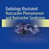 Radiology Illustrated: Nutcracker Phenomenon and Nutcracker Syndrome (Original PDF from Publisher)