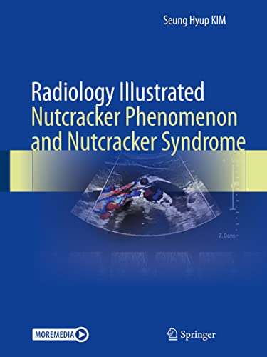 Radiology Illustrated: Nutcracker Phenomenon and Nutcracker Syndrome (Original PDF from Publisher)