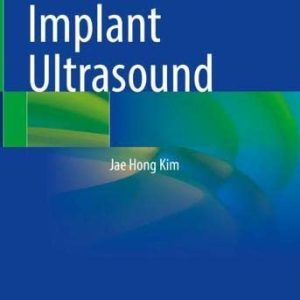 Atlas of Breast Implant Ultrasound (Original PDF from Publisher)