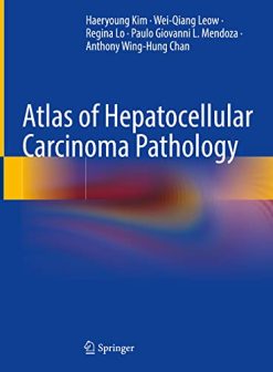 Atlas of Hepatocellular Carcinoma Pathology (Original PDF from Publisher)