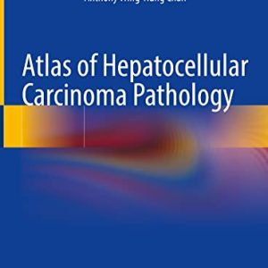 Atlas of Hepatocellular Carcinoma Pathology (Original PDF from Publisher)