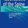 Tuberculosis of the Spine (Original PDF from Publisher)