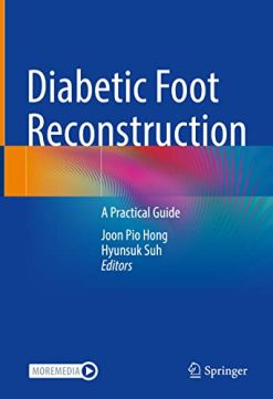 Diabetic Foot Reconstruction: A Practical Guide (Original PDF from Publisher)