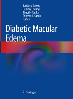 Diabetic Macular Edema (Original PDF from Publisher)