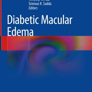 Diabetic Macular Edema (Original PDF from Publisher)