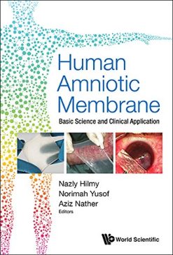 Human Amniotic Membrane: Basic Science and Clinical Application (PDF)