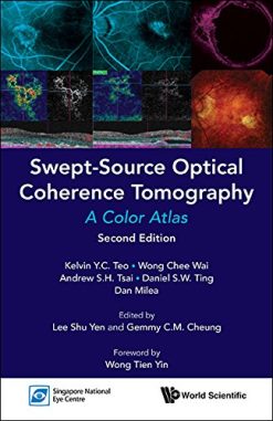 Swept-Source Optical Coherence Tomography: A Color Atlas (PDF)