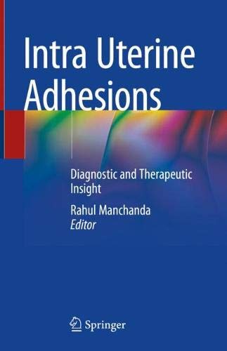 Intra Uterine Adhesions: Diagnostic and Therapeutic Insight (Original PDF from Publisher)