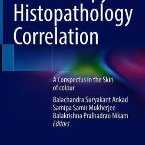 Dermoscopy – Histopathology Correlation: A Conspectus in the Skin of colour (Original PDF from Publisher)