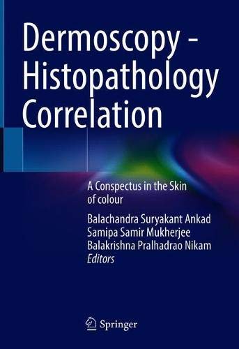 Dermoscopy – Histopathology Correlation: A Conspectus in the Skin of colour (Original PDF from Publisher)