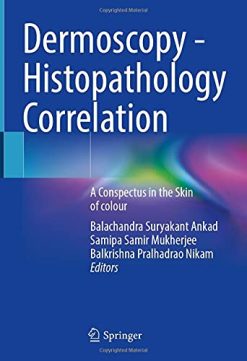 Dermoscopy – Histopathology Correlation: A Conspectus in the Skin of colour (Original PDF from Publisher)