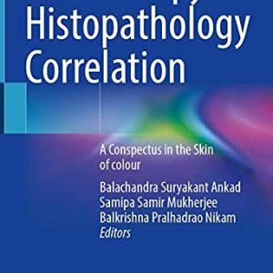 Dermoscopy – Histopathology Correlation: A Conspectus in the Skin of colour (Original PDF from Publisher)