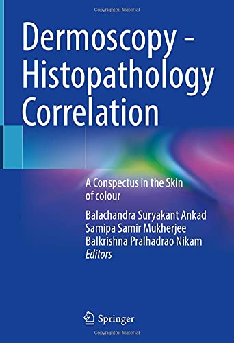 Dermoscopy – Histopathology Correlation: A Conspectus in the Skin of colour (Original PDF from Publisher)