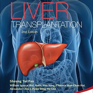Living Donor Liver Transplantation (2nd Edition)