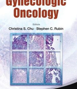 Manual Of Gynecologic Oncology