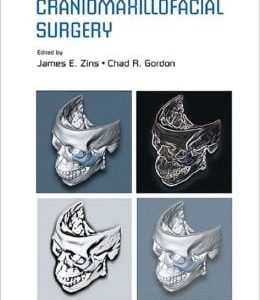 Handbook of Craniomaxillofacial Surgery (Original PDF from Publisher)