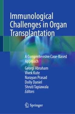 Immunological Challenges in Organ Transplantation (EPUB)