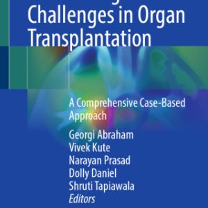 Immunological Challenges in Organ Transplantation (EPUB)
