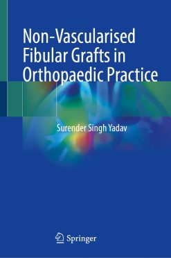 Non-Vascularised Fibular Grafts in Orthopaedic Practice (EPUB)