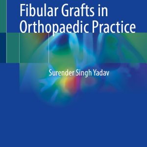 Non-Vascularised Fibular Grafts in Orthopaedic Practice (EPUB)