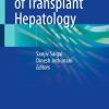 Fundamentals of Transplant Hepatology (EPUB)
