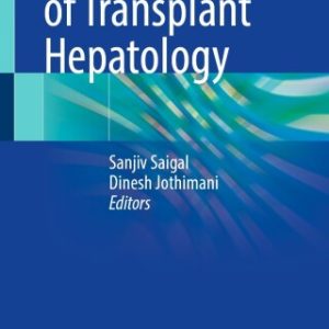 Fundamentals of Transplant Hepatology (EPUB)