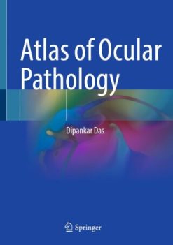 Atlas of Ocular Pathology (EPUB)