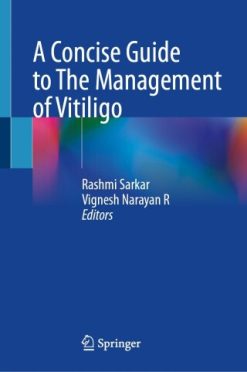 A Concise Guide to The Management of Vitiligo (Original PDF from Publisher)