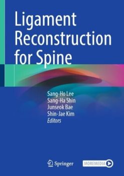 Ligament Reconstruction for Spine (EPUB)