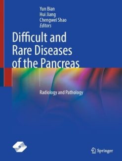 Difficult and Rare Diseases of the Pancreas (EPUB)
