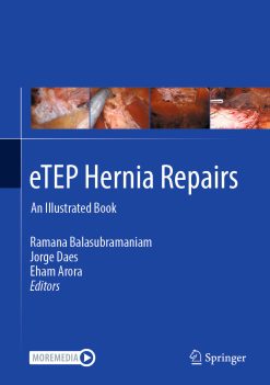 eTEP Hernia Repairs: An Illustrated Book (Original PDF from Publisher)