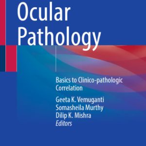 Ocular Pathology (EPUB)