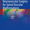 Endovascular and Neurovascular Surgery for Spinal Vascular Malformations (EPUB)